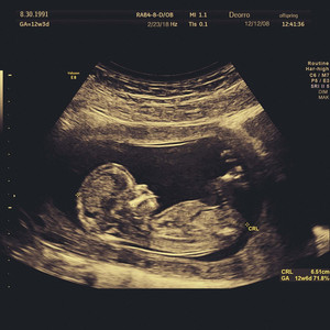 女生把🐻出和男生30分钟
